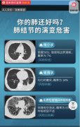 调查｜原装进口保健品声称“可治疗肺结节，